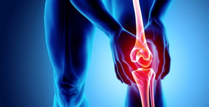 آرتروز زانو چیست و نقش فیزیوتراپی در آرتروز زانو چگونه است؟
