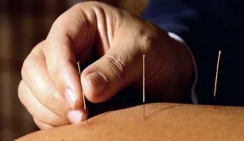 طب سوزنی بر کاهش درد و بهبود عملکرد در بیماران مبتلا به بیرون‌زدگی دیسک گردن