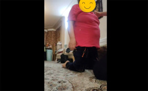 کاردرمانی بیمار سکته مغزی - تقویت عضلات لگن جهت وزن اندازی و بهبود گیت بیمار